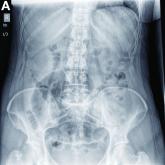 What is your diagnosis? - March 2019